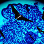 nipah-virus-30.jpeg
