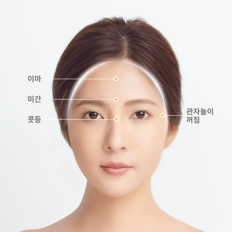 이마 — KR news